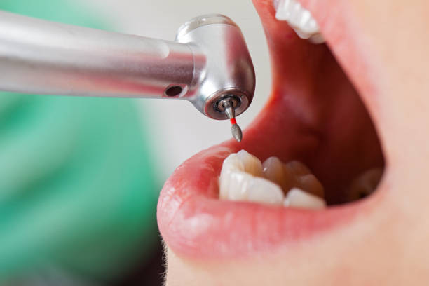 Best Emergency Dental Filling Replacement  in Lewisville, NC
